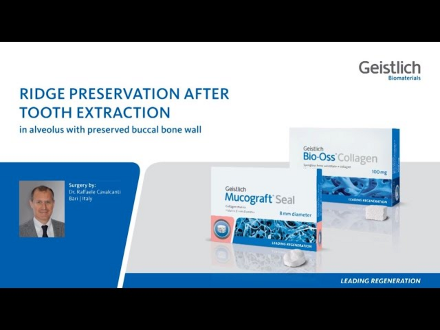 Tooth Extraction Ridge Downloads Dental Professionals - Geistlich Pharma AG