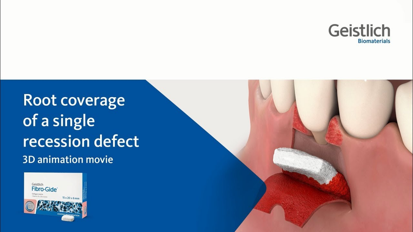 Geistlic Fibro-Gide - Geistlich Pharma AG