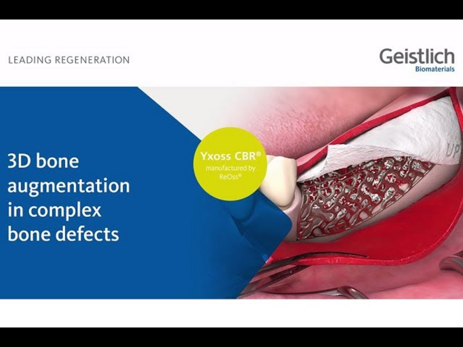 Geistlic Descargas Profesionales de la odontología - Geistlich Pharma AG