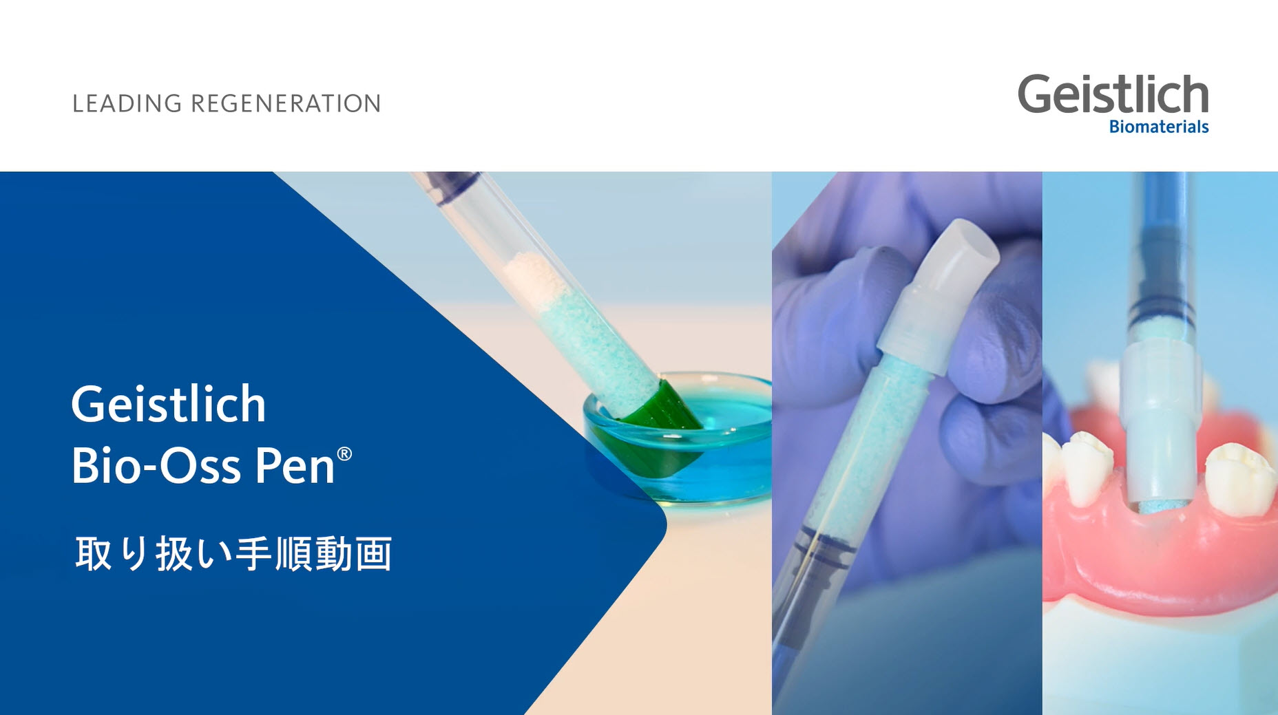 【希望者のみラッピング無料】 Geistlich Bio-Oss Pen - Geistlich Pharma AG その他